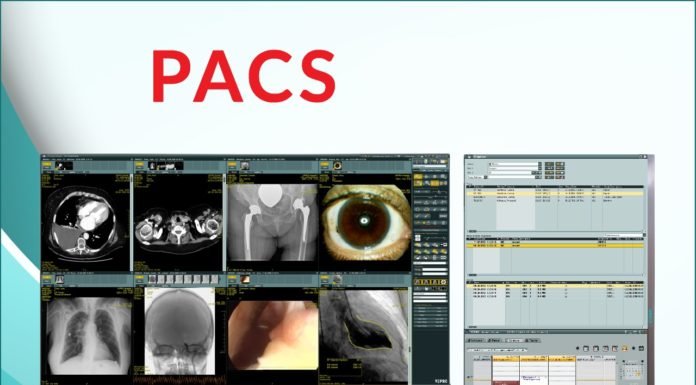 what are PACS