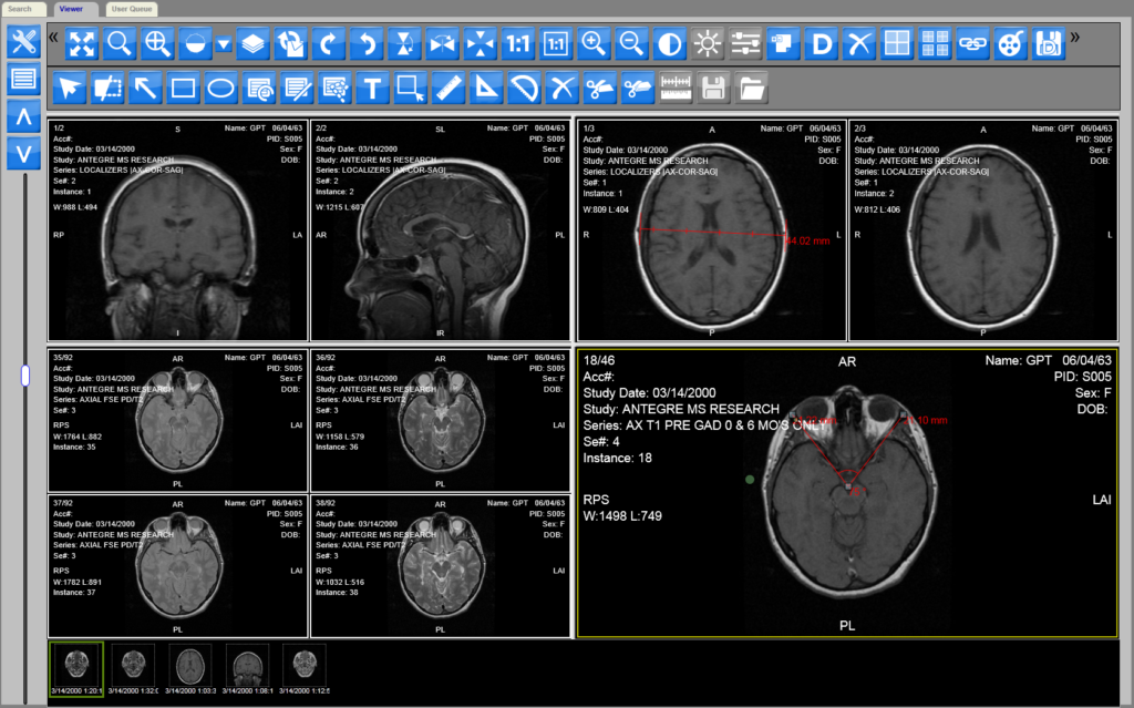 online DICOM reader