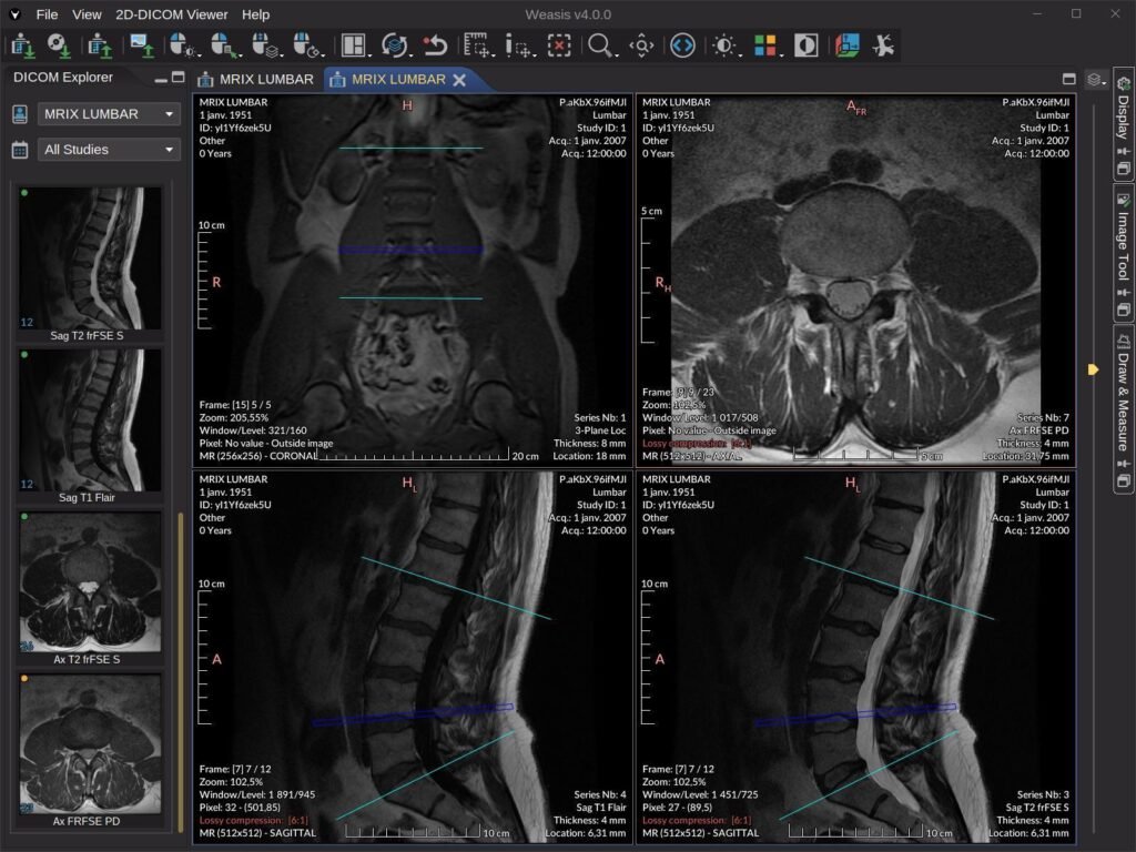 online DICOM reader