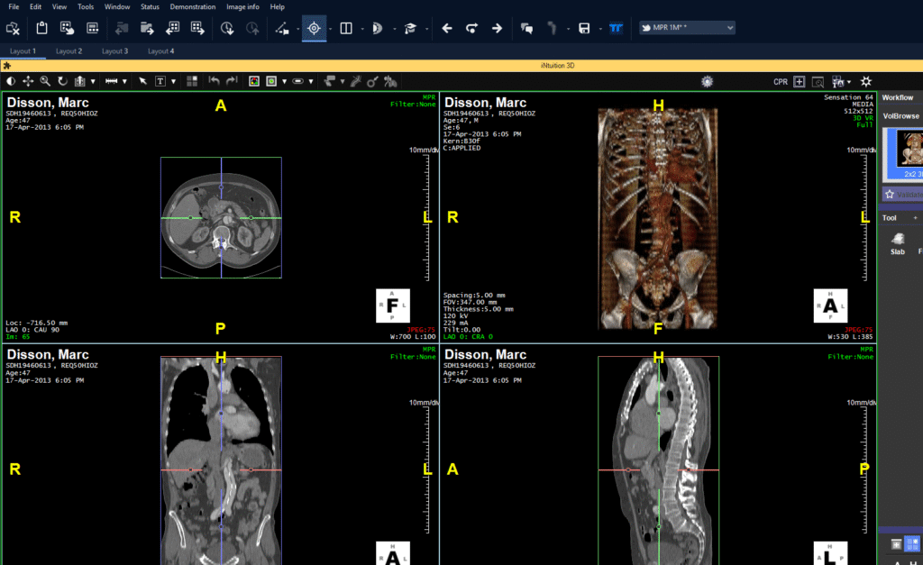 Radiology image sharing platforms