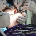 Dental Implants In Regina